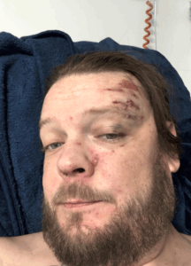 'Pawn Stars' Corey Harrison Breaks Silence On Massive Motorcycle Accident